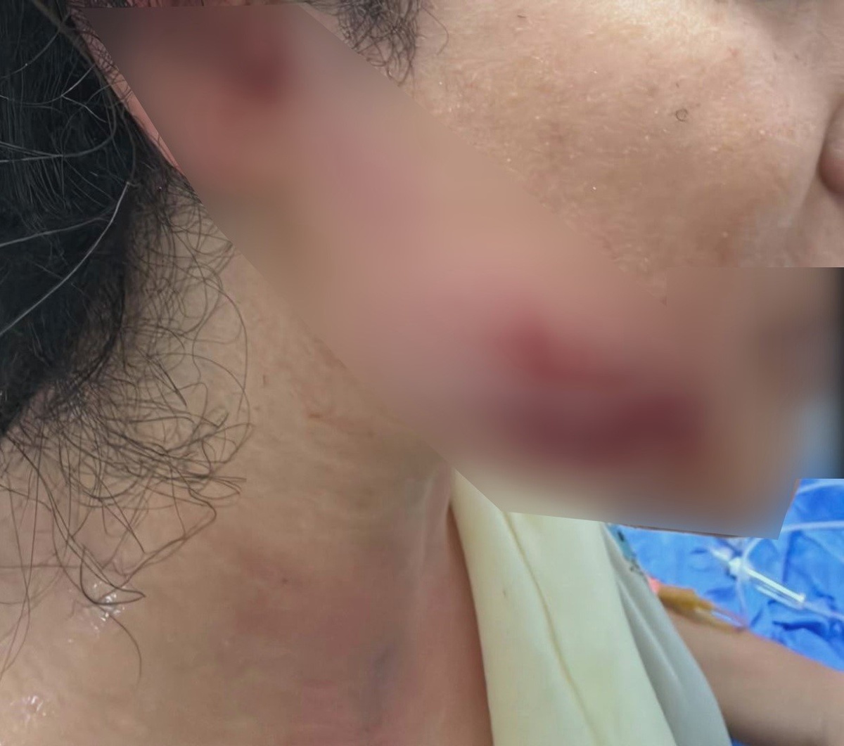Diyarbakır\'da maç sonrası havai fişek 7. kat balkonunda patladı, 2 kardeş yaralandı