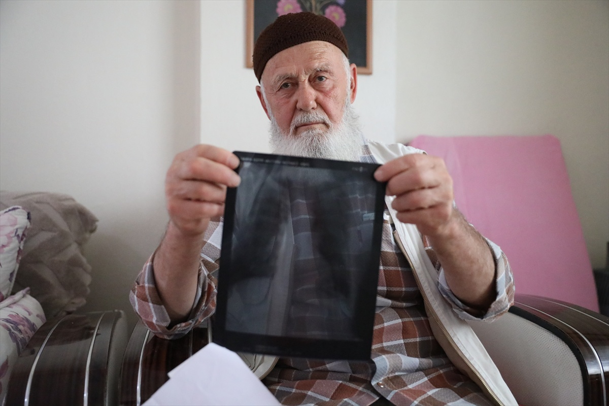 Sigaraya askerde başlayan Osman Gülay, 3 parmağını kaybetti, 16 yıldır içmiyor