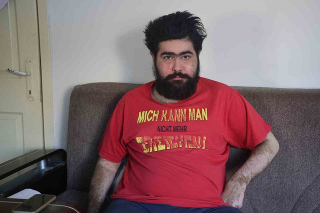 3 ay tedavi gördü ama olmadı! Barış Özbay eski hayatına geri döndü