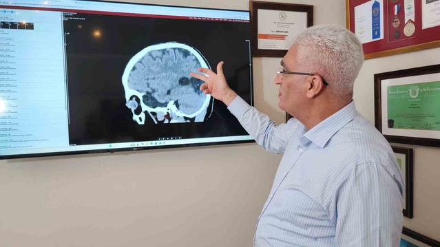 Prof. Dr. Şen, inme artışında hareketsizlik ve işlenmiş gıdaya dikkat çekti