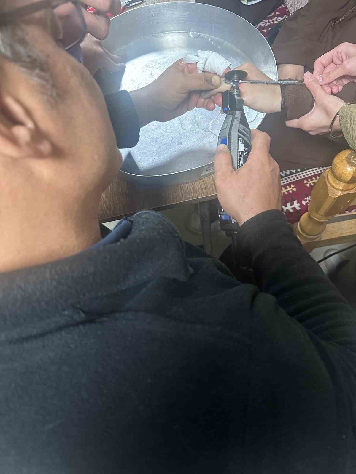 Batman\'da parmağına yüzük sıkışan vatandaşa hastanede itfaiye ekipleri müdahale etti