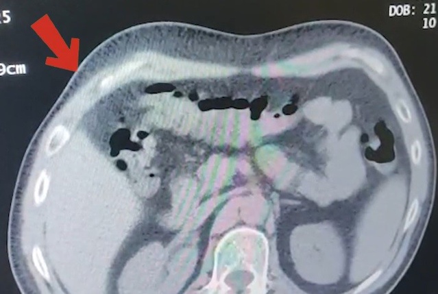 Tatvan'da durdurulan otobüste 608 gram metamfetamin taşıyan yolcu tutuklandı