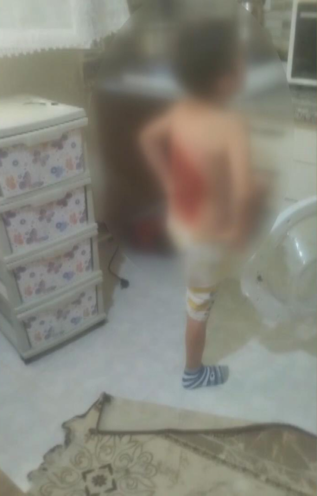 12 yaşındaki çocuğu diri diri yaktılar! Sonrası daha da korkunç
