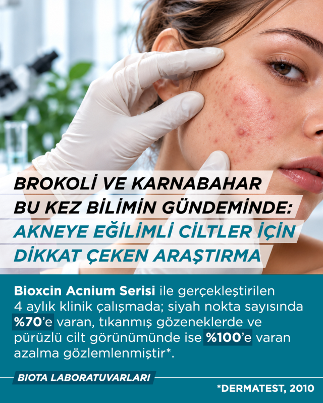 BROKOLİ VE KARNABAHAR BU KEZ BİLİMİN GÜNDEMİNDE: AKNEYE EĞİLİMLİ CİLTLER İÇİN DİKKAT ÇEKEN ARAŞTIRMA