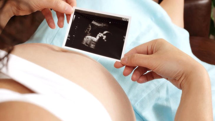 Ultrason fotoğraflarına bakan anne, bebeğinin yüzünü görünce şoke oldu