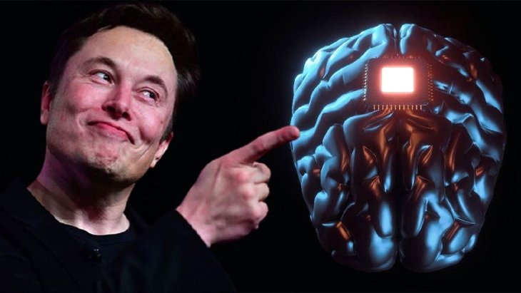Elon Musk’ın son projesi: İnsan beynine çip takmaya hazırlanıyor
