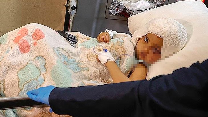 Pitbull saldırısında ağır yaralanan minik Asiye taburcu edildi İşte son hali