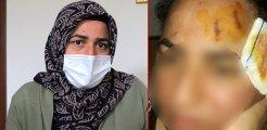3 buçuk aylık hamile kadının evini komşuları bastı: Yüzüme tencereyle vurdu, kafamda poşet parçaladı