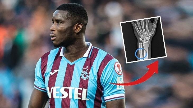 Trabzonsporlu Onuachu'nun kolunda ezilme ve kısmi kırık tespit edildi