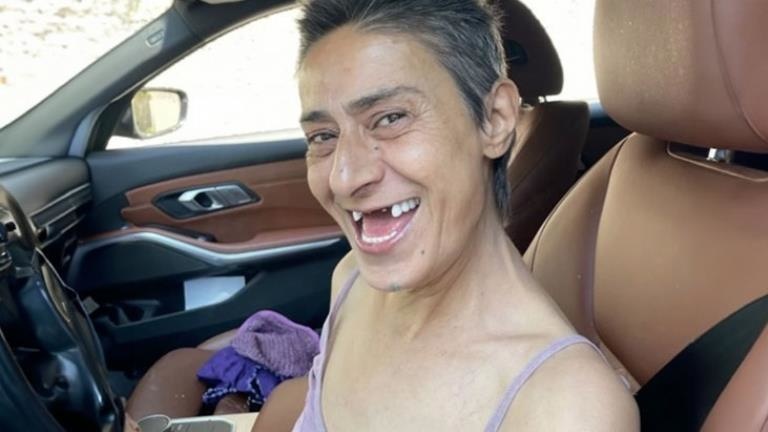 Y�ld�z Tilbe'nin Di� Tedavisi Payla��mlar� G�ndem Oldu